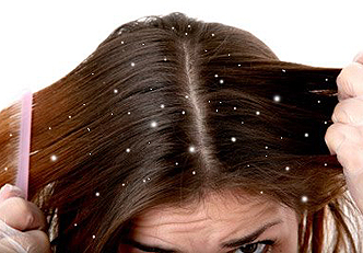 remedies-home-to-fight-the-dandruff