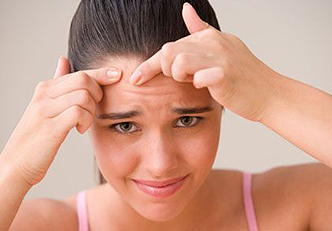 Dicas simples para tratar a acne hormonal
