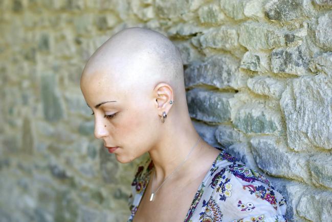 Controlar a queda de cabelo durante a quimioterapia