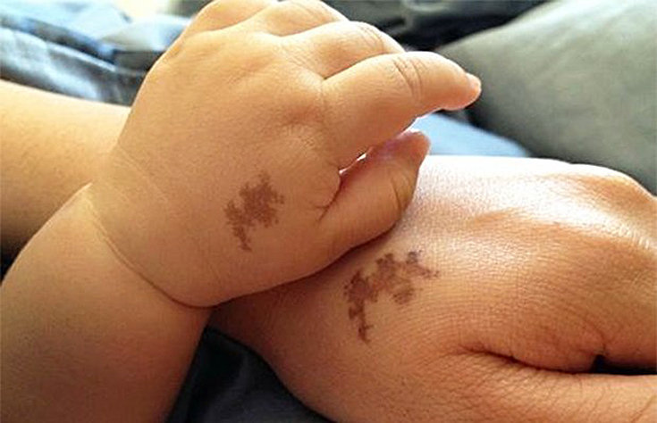 Por que alguns bebês têm marca de nascença?