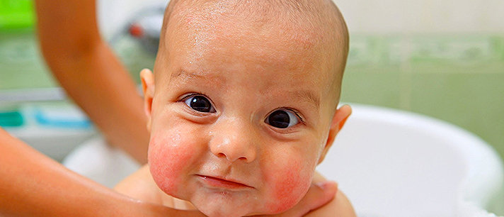 Aprenda como limpar os olhos e o nariz do bebê