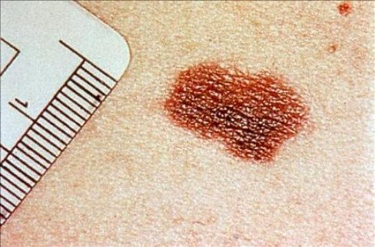 As 8 doenças de pele mais comuns