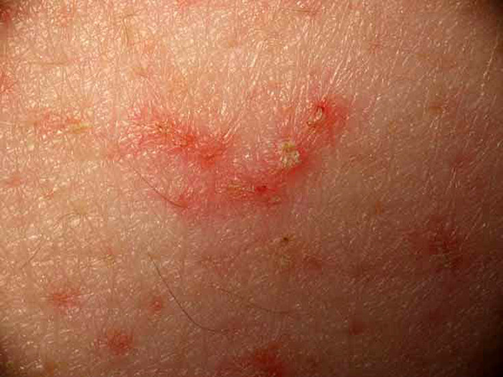 As 8 doenças de pele mais comuns