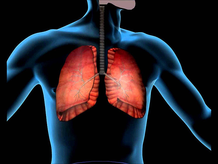 Embolia pulmonar: sintomas, causas, tratamentos e mais!