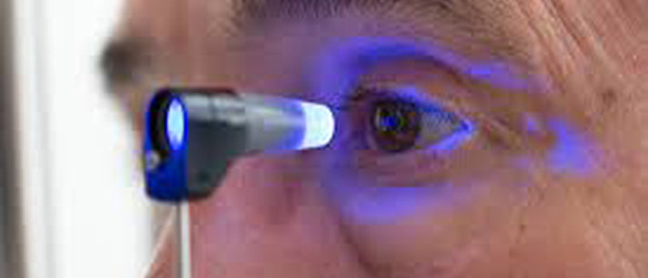 Glaucoma: tipos, sintomas, diagnóstico, tratamento e mais!