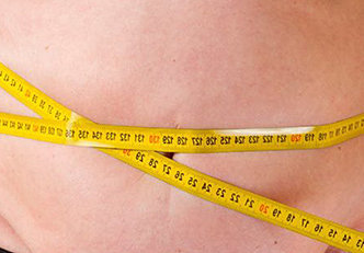 Obesidade: o que é, causas, sintomas, tratamentos e mais!